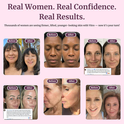DermaLift™ Sculpt Balm